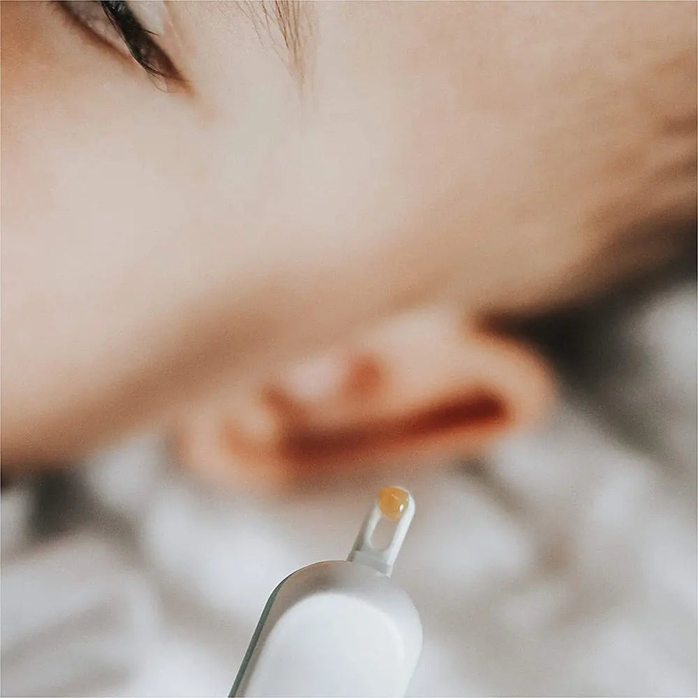 Frida Baby 3 In 1 Nose  Nail + Ear Picker  Essential Booger Picker Tool Frida Baby Yallatoys