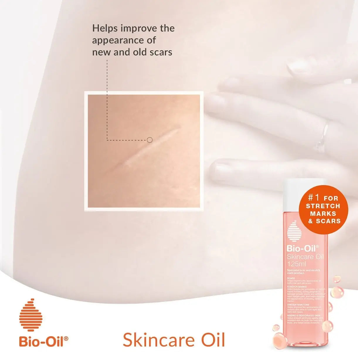 Bio-Oil 60Ml Bio-Oil Yallatoys