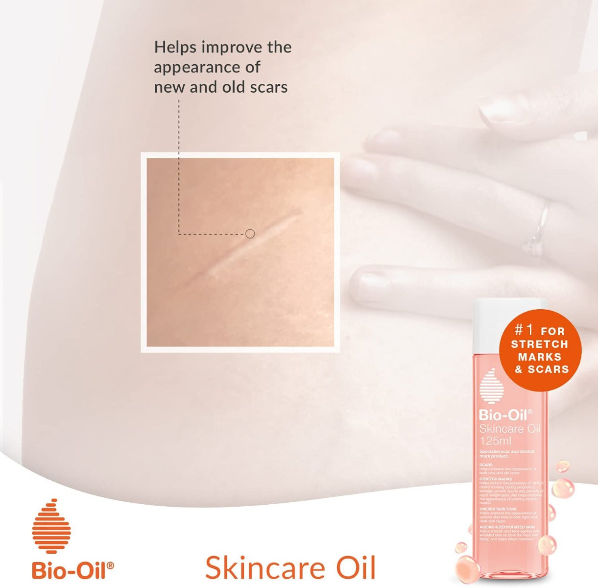 Bio-Oil 125Ml Bio-Oil Yallatoys