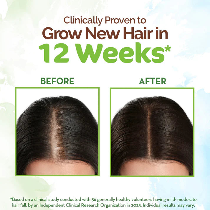 Mamaearth Rosemary Hair Growth Oil 150ml Regular Mamaearth Yallatoys