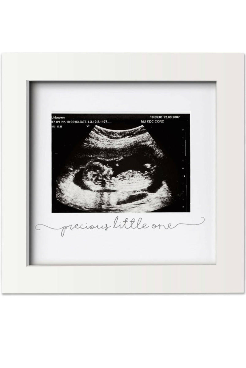 KeaBabies Sonogram Frame Alpine White KeaBabies Yallatoys