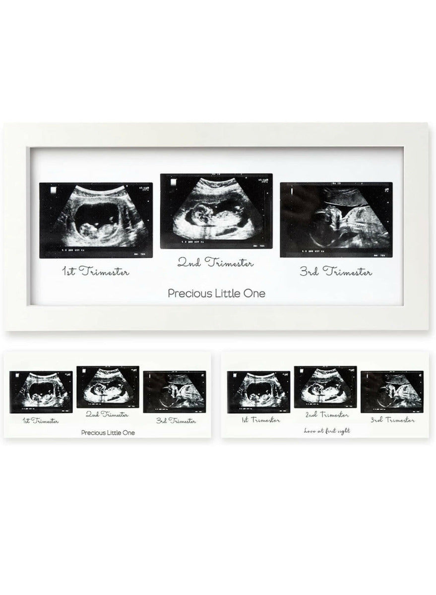 KeaBabies Trio Sonogram Frame Alpine White KeaBabies Yallatoys